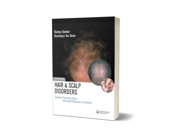 Hair and Scalp Disorders Common Presenting Signs Differential Diagnosis